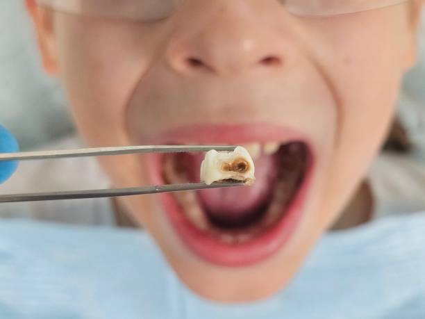 Best Emergency Care for Gum Disease in Franklin, TX